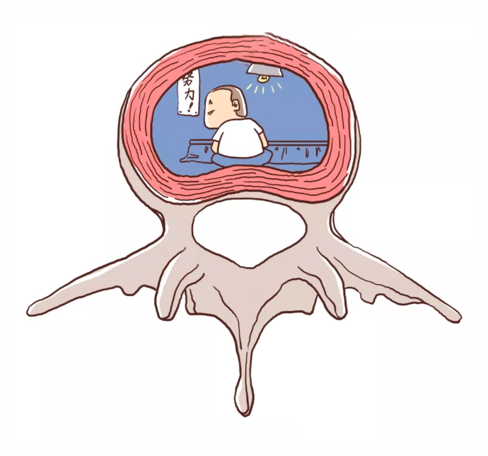 健康养生 中医三法六招调护腰椎间盘突出症